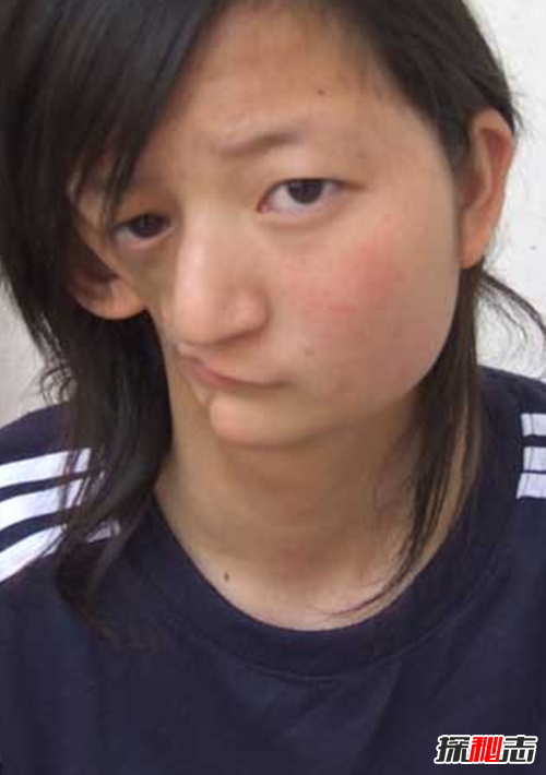 最恐怖的40种怪病,英国8岁少女患睡美人症(身体一夜神秘瘫痪)472 / 作者:UFO爱好者 / 帖子ID:104820