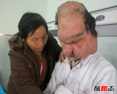 最恐怖的40种怪病,英国8岁少女患睡美人症(身体一夜神秘瘫痪)65 / 作者:UFO爱好者 / 帖子ID:104820