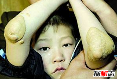 最恐怖的40种怪病,英国8岁少女患睡美人症(身体一夜神秘瘫痪)50 / 作者:UFO爱好者 / 帖子ID:104820