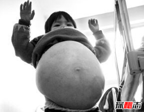 最恐怖的40种怪病,英国8岁少女患睡美人症(身体一夜神秘瘫痪)970 / 作者:UFO爱好者 / 帖子ID:104820