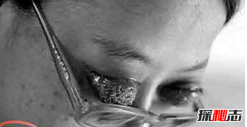 最恐怖的40种怪病,英国8岁少女患睡美人症(身体一夜神秘瘫痪)577 / 作者:UFO爱好者 / 帖子ID:104820