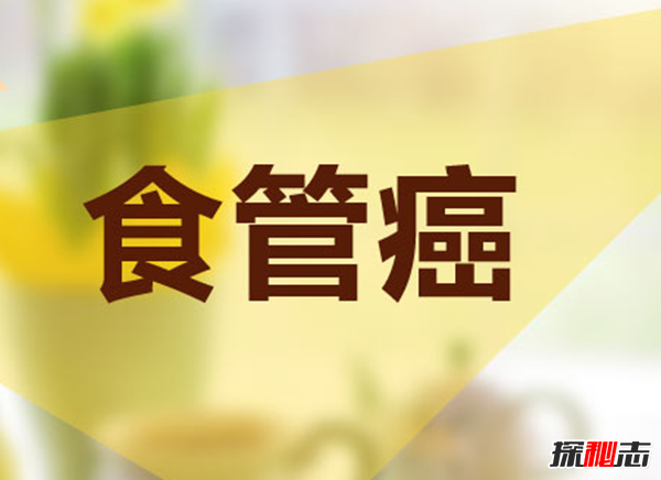 你知道吗?最难治愈的十大癌症,胰腺癌被称为癌中之王(死亡率高)818 / 作者:UFO爱好者 / 帖子ID:104851