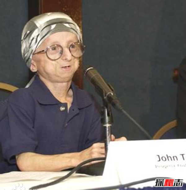 不忍直视!全球十大目前还无法治愈的恐怖怪病,僵尸癖有自杀倾向297 / 作者:UFO爱好者 / 帖子ID:104853