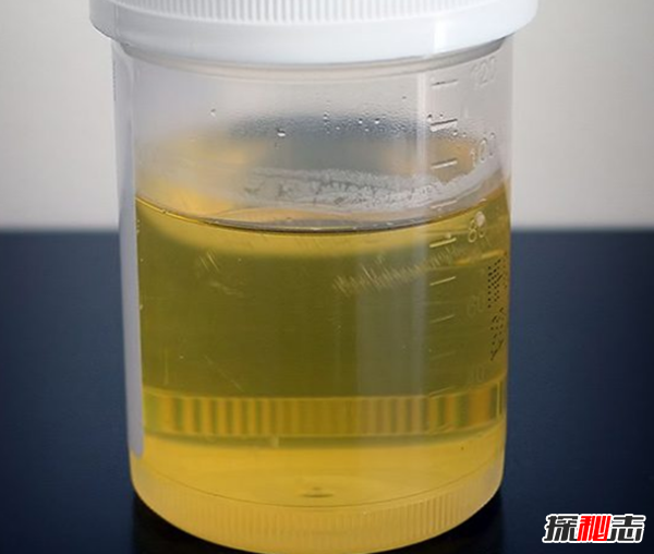 世界上最奇葩的非食物物品有哪些?十大奇怪的饮食行为事实301 / 作者:UFO爱好者 / 帖子ID:104776