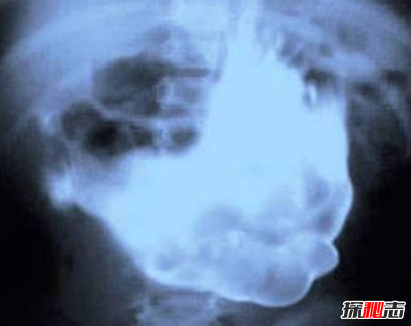 x光片发现十大最恐怖的东西,你绝对想不到居然有它711 / 作者:UFO爱好者 / 帖子ID:104595