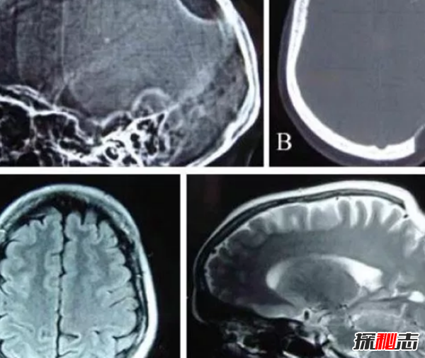 人骨为什么那么可怕?人体骨骼的十大疯狂事实862 / 作者:UFO爱好者 / 帖子ID:89181