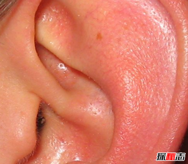 吃鱿鱼怀了宝宝?发生在自己身边的十大怪事888 / 作者:UFO爱好者 / 帖子ID:104522
