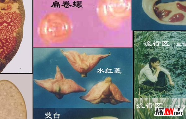 人体寄生虫有哪些种类?寄生虫对人体的十大危害932 / 作者:UFO爱好者 / 帖子ID:77591