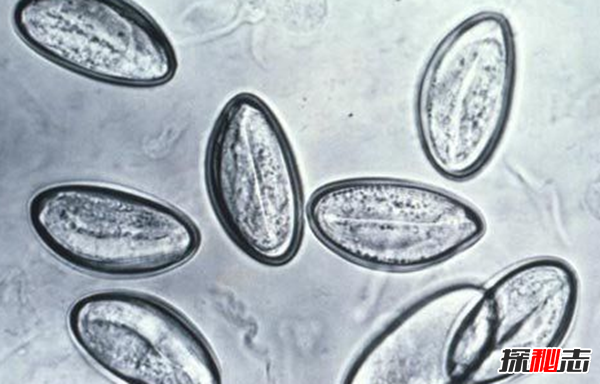 人体寄生虫有哪些种类?寄生虫对人体的十大危害570 / 作者:UFO爱好者 / 帖子ID:77591