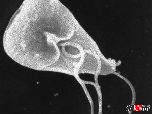 人体寄生虫有哪些种类?寄生虫对人体的十大危害181 / 作者:UFO爱好者 / 帖子ID:77591