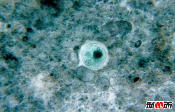 人体寄生虫有哪些种类?寄生虫对人体的十大危害36 / 作者:UFO爱好者 / 帖子ID:77591