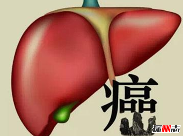 肝癌发病率最高的国家排名 埃及榜上第四,第一酒精过度依赖670 / 作者:UFO爱好者 / 帖子ID:97700