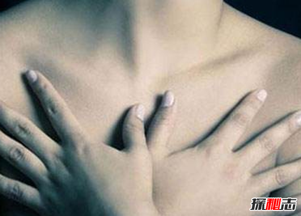 乳腺癌发病率前十国家排名 法国第三,基因突变好可怕823 / 作者:UFO爱好者 / 帖子ID:97679