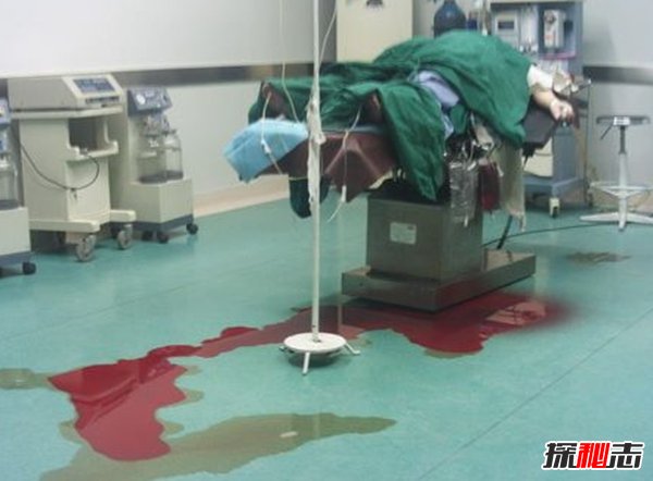 生孩子为什么孕妇会死?孕产妇死亡率最高的十个国家261 / 作者:UFO爱好者 / 帖子ID:96362