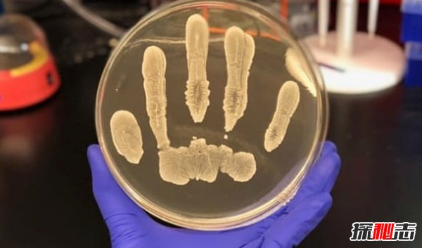 什么细菌最厉害?揭秘世界上十大最强细菌(所向披靡)668 / 作者:UFO爱好者 / 帖子ID:96154