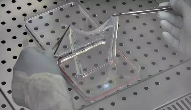 更换80%表皮,基因疗法拯救致命皮肤病患儿生命770 / 作者:UFO爱好者 / 帖子ID:85875 更换80%表皮,基因疗法拯救致命皮肤病患儿生命770 / 作者:UFO爱好者 / 帖子ID:85875