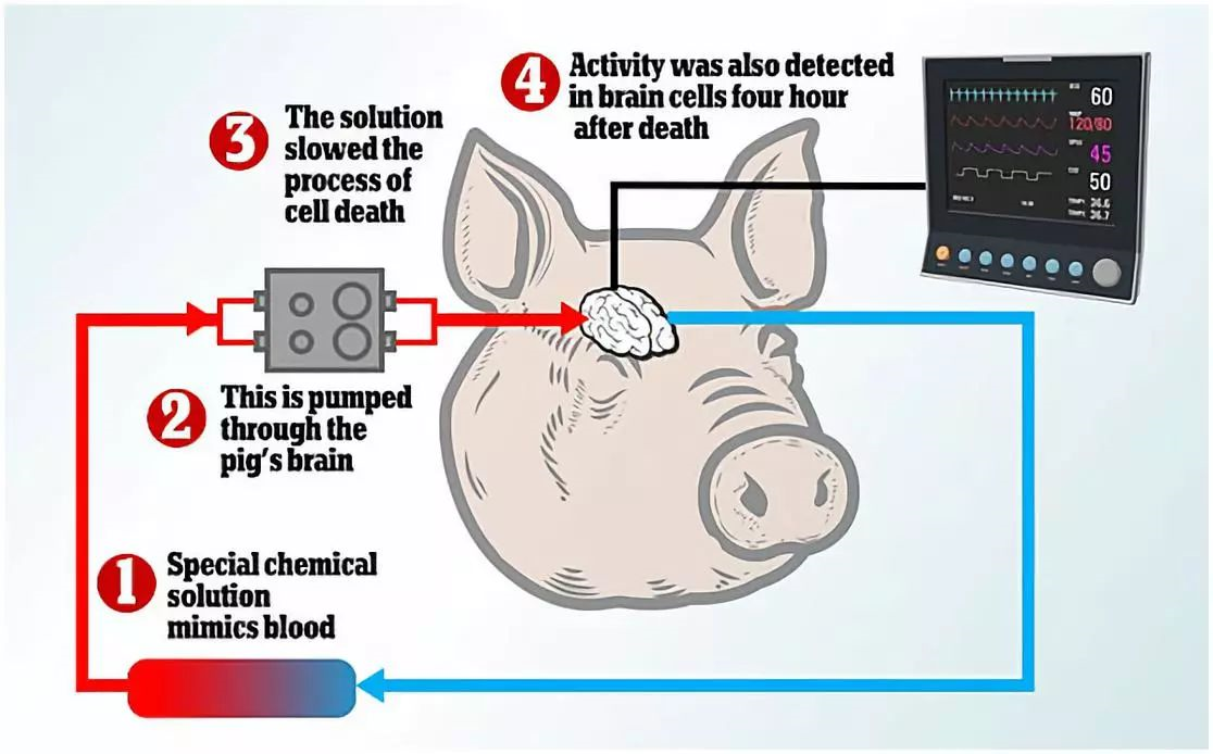 脑死亡再复活？科学家恢复猪脑964 / 作者:UFO爱好者 / 帖子ID:85374