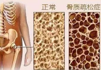 现代生活是如何改变人类骨骼的？927 / 作者:UFO爱好者 / 帖子ID:85039