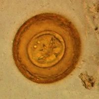 为了治疗自闭症他定期喝下数十条蠕虫501 / 作者:UFO爱好者 / 帖子ID:84779