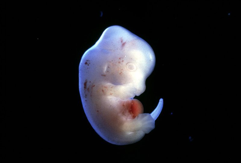 日本批准首个动物胚胎的人体器官培育试验259 / 作者:UFO爱好者 / 帖子ID:84717 日本批准首个动物胚胎的人体器官培育试验259 / 作者:UFO爱好者 / 帖子ID:84717