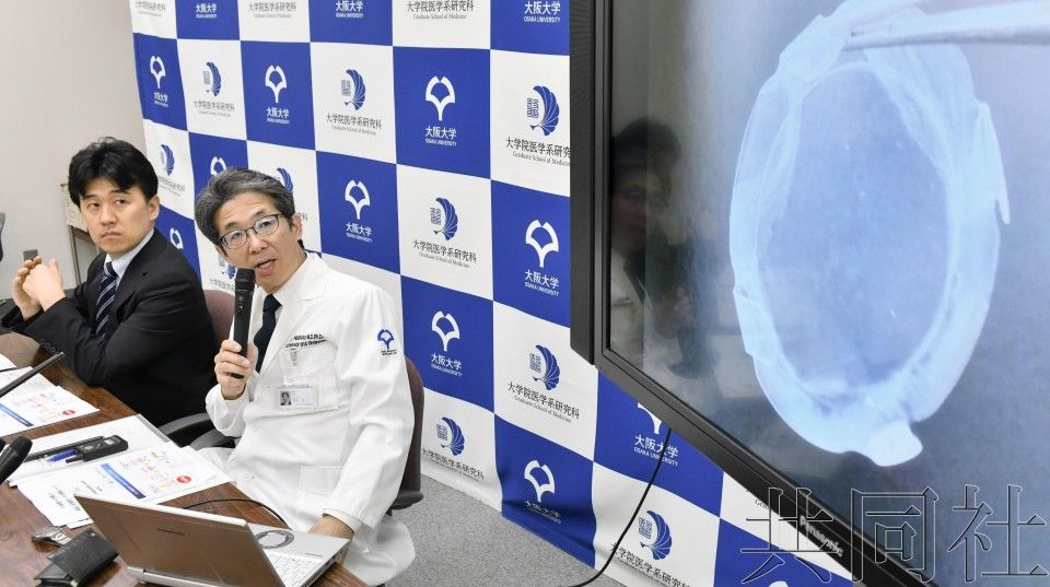 大阪大学完成全球首例 iPS 角膜移植18 / 作者:UFO爱好者 / 帖子ID:84308 大阪大学完成全球首例 iPS 角膜移植18 / 作者:UFO爱好者 / 帖子ID:84308