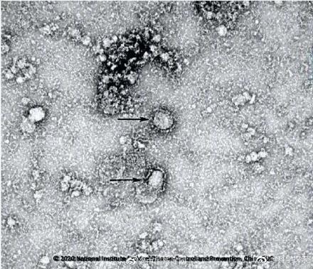 科学的说 我们确实不知道新冠病毒真正源头是哪里247 / 作者:UFO爱好者 / 帖子ID:82336