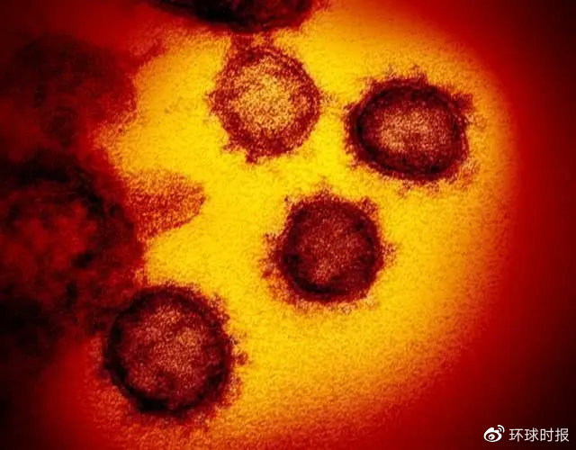科学家发现新的新冠病毒毒株421 / 作者:UFO爱好者 / 帖子ID:80613 科学家发现新的新冠病毒毒株421 / 作者:UFO爱好者 / 帖子ID:80613