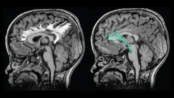 2020年8月11日环球科学要闻858 / 作者:UFO爱好者 / 帖子ID:78375