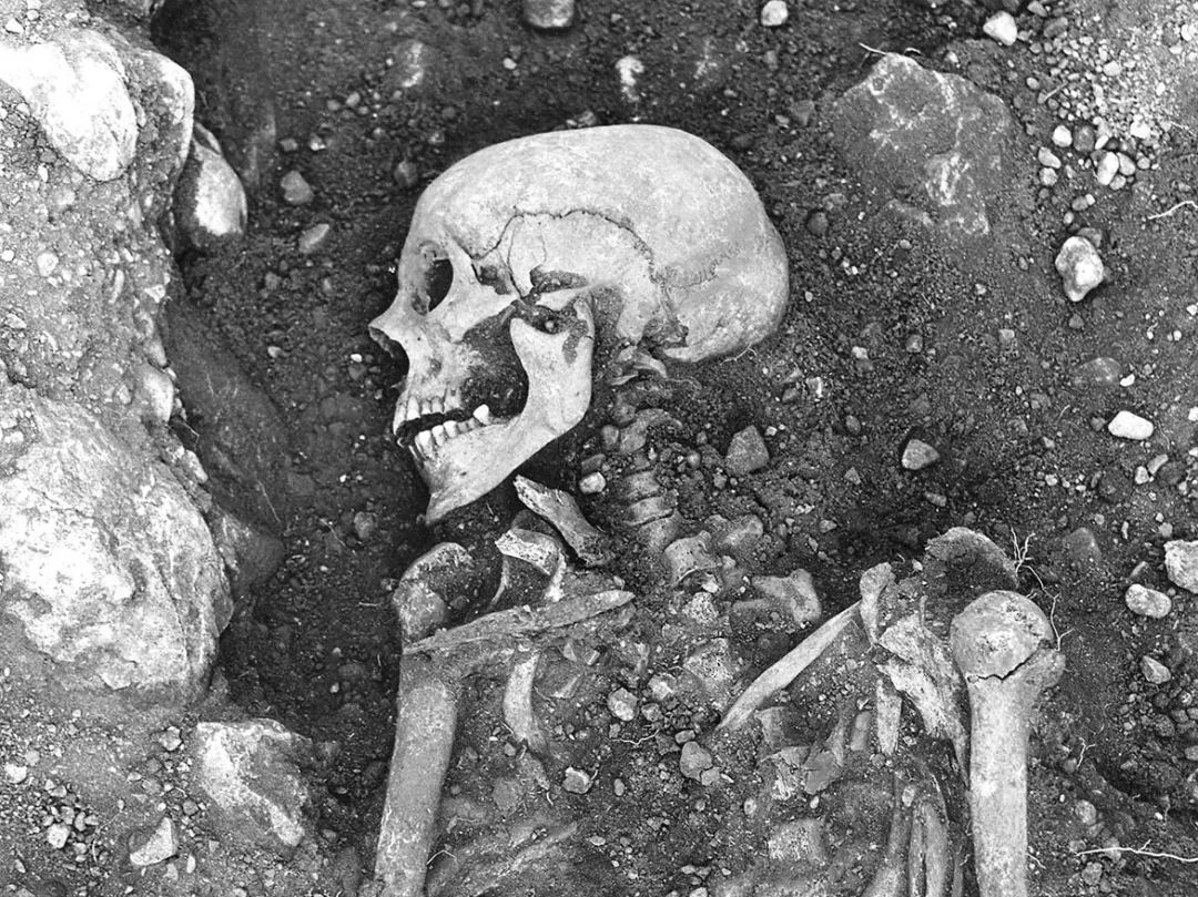 揭秘1700年前的天花病人386 / 作者:UFO爱好者 / 帖子ID:78176 揭秘1700年前的天花病人386 / 作者:UFO爱好者 / 帖子ID:78176