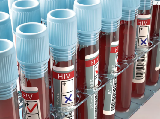 世界上首位HIV感染治愈者去世了428 / 作者:UFO爱好者 / 帖子ID:76802 世界上首位HIV感染治愈者去世了428 / 作者:UFO爱好者 / 帖子ID:76802
