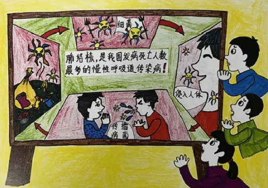 新冠疫情下的结核阴影299 / 作者:UFO爱好者 / 帖子ID:76552