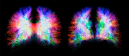 2020年11月2日环球科学要闻7 / 作者:UFO爱好者 / 帖子ID:76188