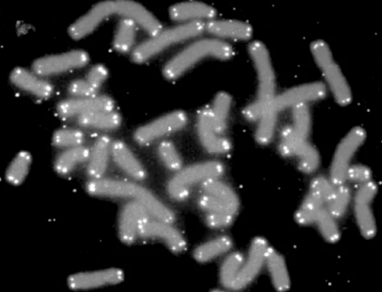 高压氧疗法逆转衰老,3个月端粒可延长38%383 / 作者:UFO爱好者 / 帖子ID:75274 高压氧疗法逆转衰老,3个月端粒可延长38%383 / 作者:UFO爱好者 / 帖子ID:75274