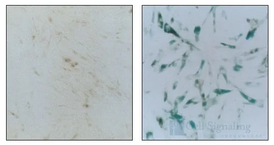 一文总结:细胞衰老十大标志物94 / 作者:UFO爱好者 / 帖子ID:73869 一文总结:细胞衰老十大标志物94 / 作者:UFO爱好者 / 帖子ID:73869
