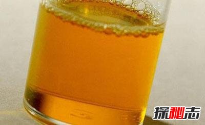低智商的九种表现是什么？687 / 作者:UFO爱好者 / 帖子ID:105732
