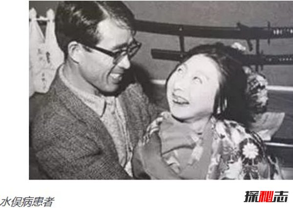 日本水俣病事件,环境污染导致人们染上“怪病”864 / 作者:UFO爱好者 / 帖子ID:105354