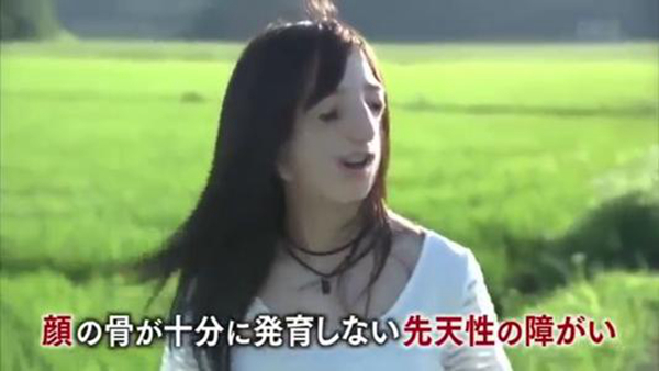 无脸症是什么?世界上真的有没有脸的人吗989 / 作者:UFO爱好者 / 帖子ID:80245