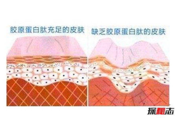 长期喝胶原蛋白的危害 这三大危害影响身体749 / 作者:UFO爱好者 / 帖子ID:87132