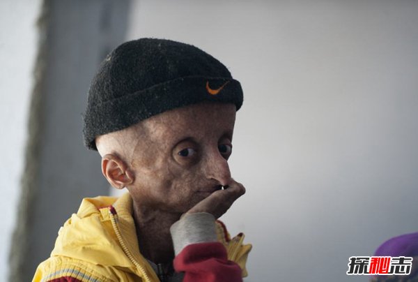 世界上十大必死病 第一病发死亡率百分百疫苗可预防361 / 作者:UFO爱好者 / 帖子ID:96160