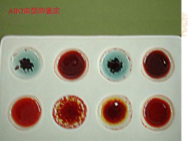 ABO血型系统是什么?血型是按照什么来划分的764 / 作者:UFO爱好者 / 帖子ID:87941