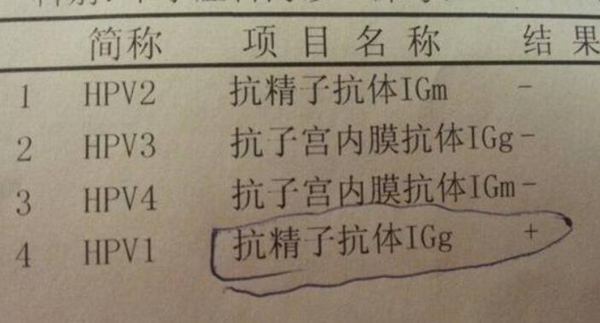 精元抗体是什么意思?GPAL化验单了解女性几个前任?229 / 作者:UFO爱好者 / 帖子ID:104081
