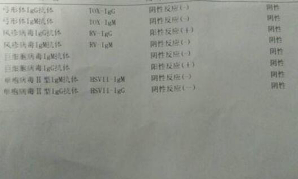 精元抗体是什么意思?GPAL化验单了解女性几个前任?693 / 作者:UFO爱好者 / 帖子ID:104081