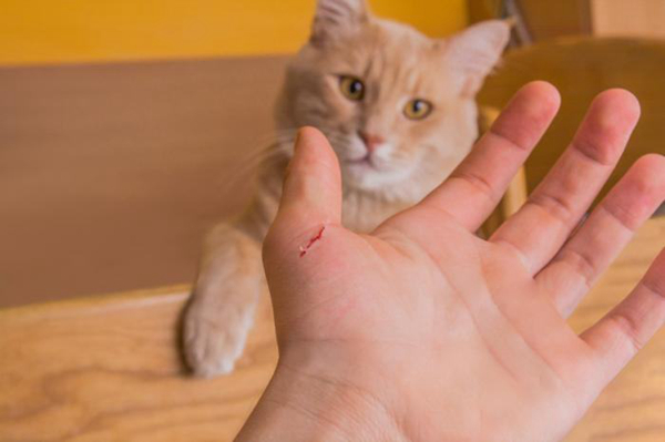 猫抓病是什么病?猫抓病会死吗（汉赛巴通体病毒引起）800 / 作者:UFO爱好者 / 帖子ID:83228