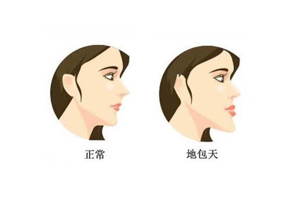 矫正牙齿对以后有影响吗?矫正牙齿利与弊有哪些?515 / 作者:UFO爱好者 / 帖子ID:83303