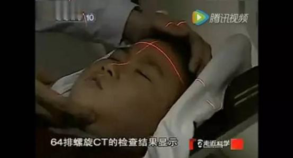 僵尸男孩怎么回事 龇牙咧嘴爱吸血犹如僵尸附体788 / 作者:UFO爱好者 / 帖子ID:103790