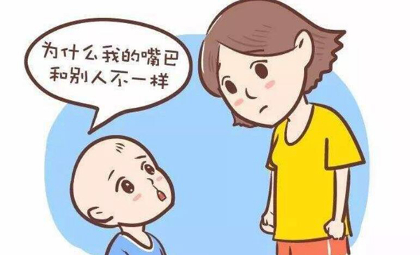 兔唇是什么原因造成的?婴儿兔唇应该怎么办60 / 作者:UFO爱好者 / 帖子ID:80825