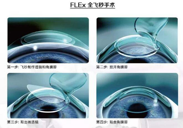 要不要做近视眼激光手术?近视眼手术有后遗症吗90 / 作者:UFO爱好者 / 帖子ID:82376