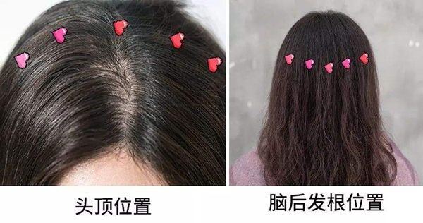 怎样才能改善油性头发?揭秘让头发不油的小妙招764 / 作者:UFO爱好者 / 帖子ID:82217