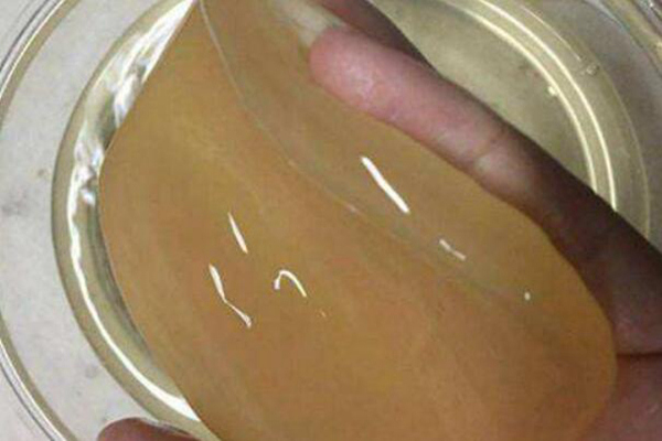 醋蛾子的危害有哪些 不影响身体（胶膜醋酸杆菌）210 / 作者:UFO爱好者 / 帖子ID:75441