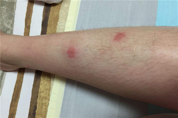 家里跳虫怎么产生的 家里有跳虫怎么清理242 / 作者:UFO爱好者 / 帖子ID:89174